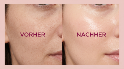 Niola Vorher Nachher